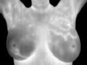 Thermography in Medicine Colour Map 2