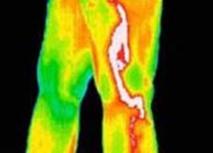Thermography in Medicine Colour Map 8